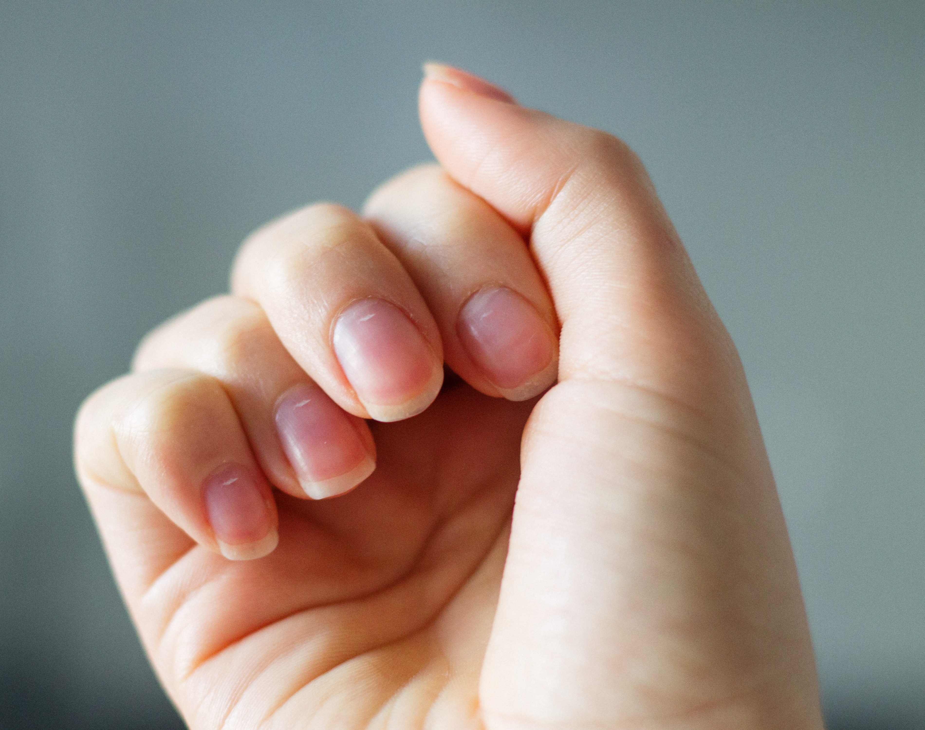 Colour Changes In Your Nails: What Does It Mean?